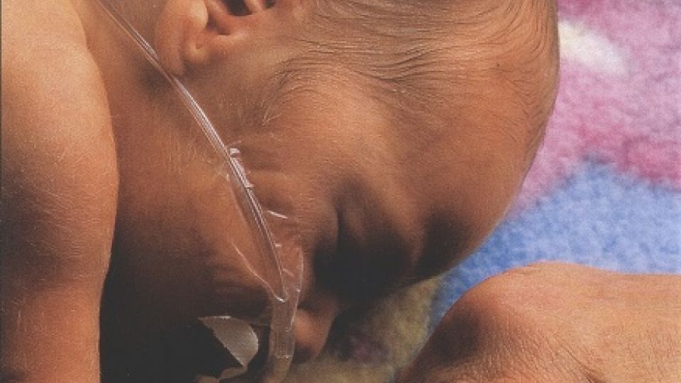 Novorozenci jsou vystaveni toxickým ftalátům
